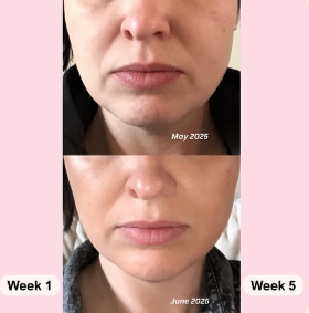 Benefits of ingredients in Collagen Boost Gummies for skin, hair, and nails support.